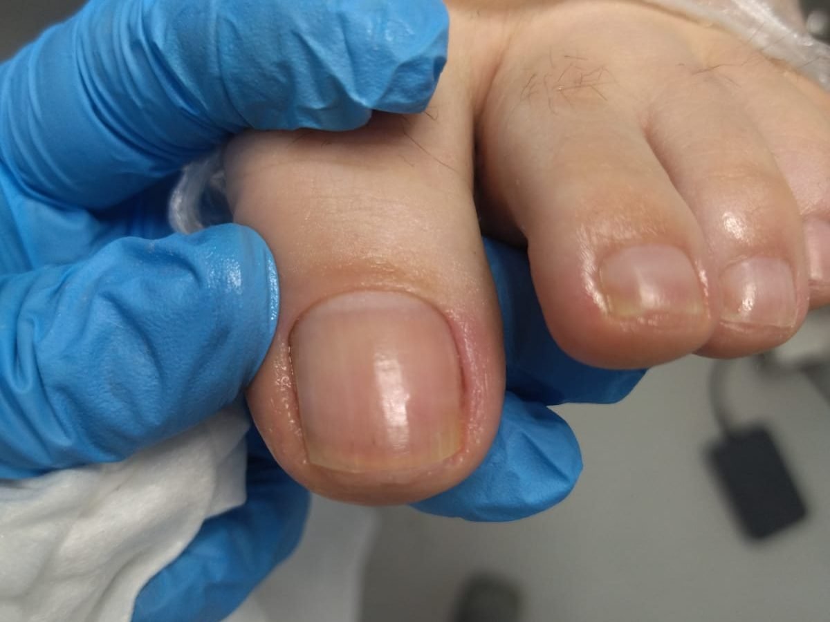 Atendimento podológico em andamento, com luvas e material descartável